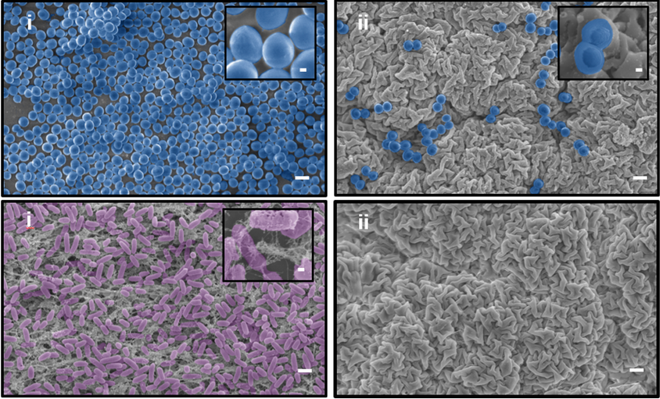 Vật liệu siêu chống dính: Ngay cả vi khuẩn kháng kháng sinh cũng không thể bám lên được - Ảnh 2.