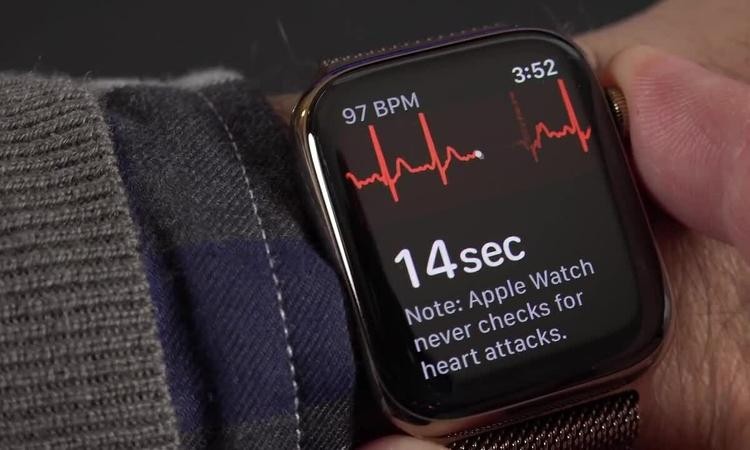 Thử đo điện tâm đồ bằng Apple Watch. Vide: YouTube DetroitBORG Thử đo điện tâm đồ bằng Apple Watch. Vide: YouTube DetroitBORG