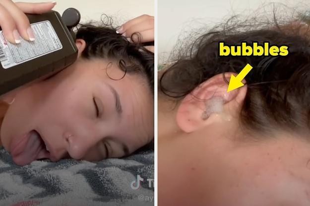 Tiktoker Ayisha sử dụng dung dịch oxy già để làm sạch tai. Ảnh: BuzzFeed.