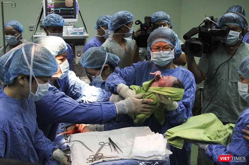 GS.TS Nguyễn Thị Ngọc Phượng và TS.Trần Đình Vinh trực tiếp thực hiện ca sinh cho 1 trong 3 bé đầu tiên sinh bằng kỹ thuật thụ tinh trong ống nghiệm tại BVện Phụ sản - Nhi Đà Nẵng