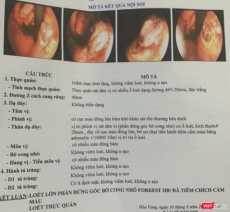 Kết quả chẩn đoán hình ảnh nội soi đối với bệnh nhân