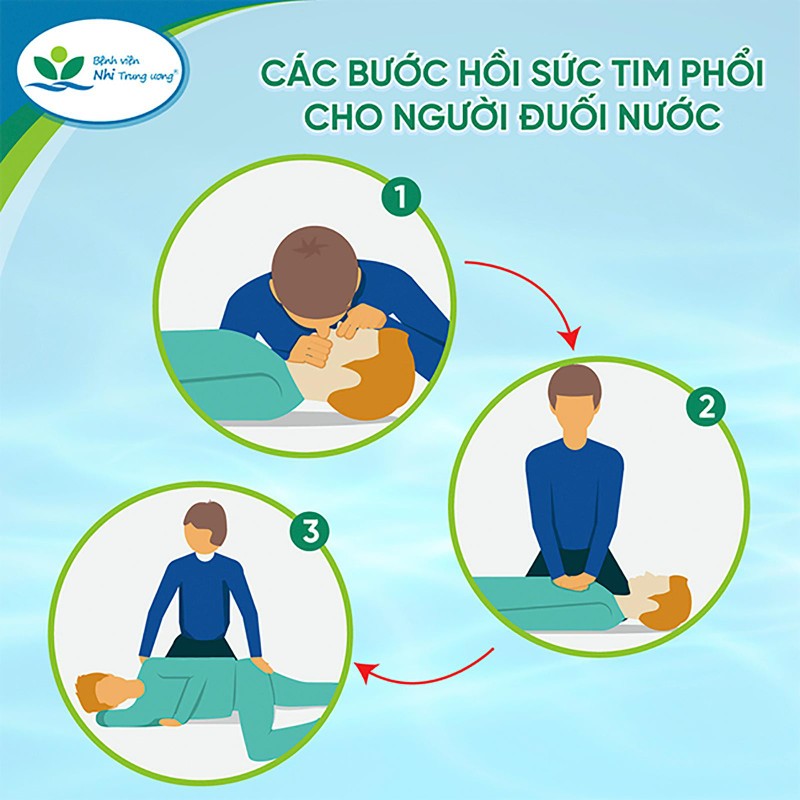 Hướng dẫn cấp cứu đối với người bị đuối nước (ảnh: Bệnh viện cung cấp)