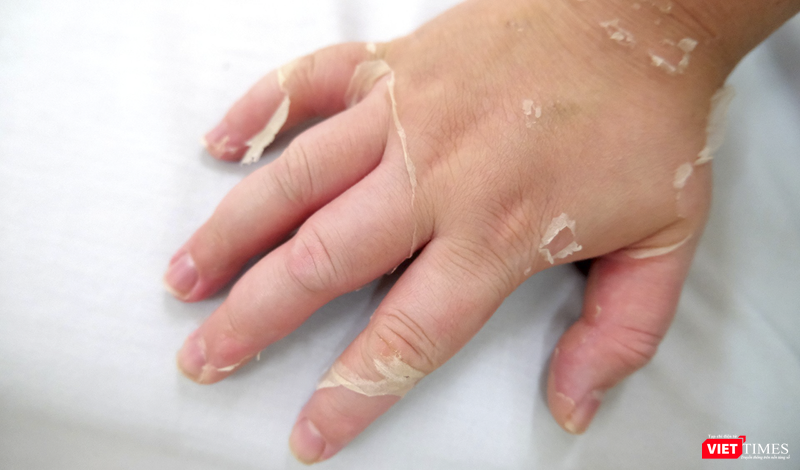 vt_lam dung thuoc xit mui 1.png