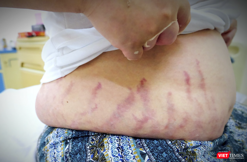 vt_lam dung thuoc xit mui 2.png