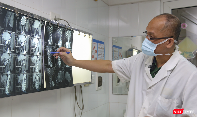 PGS.TS. Nguyễn Hồng Hà - Trưởng khoa Phẫu thuật Hàm mặt, Tạo hình và Thẩm mỹ, Bệnh viện Hữu nghị Việt Đức chẩn đoán hình ảnh bệnh lý của bệnh nhân