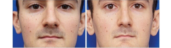 Bí mật sống ảo: Chụp selfie khiến mũi bạn trông to hơn thực tế - Ảnh 1