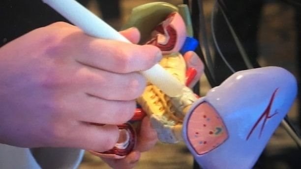 'Bút ung thư' phát hiện ra bệnh ung thư trong chỉ 20 giây - Ảnh 1