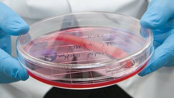 Máy in sinh học có thể giúp tạo ra những bộ phận cơ thể có thể thay thế bộ phận bị hỏng, như niệu đạo trong hình. Máy in sinh học có thể giúp tạo ra những bộ phận cơ thể có thể thay thế bộ phận bị hỏng, như niệu đạo trong hình.