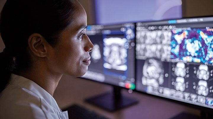 AI hỗ trợ chụp CT MRI.jpg