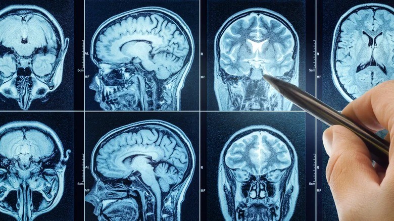 nao - Shutterstocks.jpg