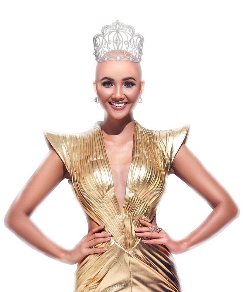 Liệu công chúng có quá "sốc" với hình ảnh không có tóc của H' Hen Niê Liệu công chúng có quá "sốc" với hình ảnh không có tóc của H' Hen Niê