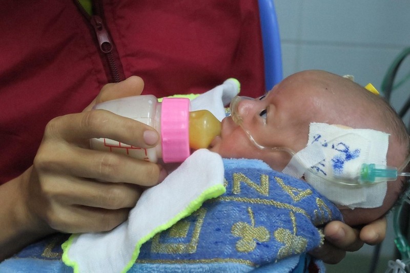 Nghẹt thở cứu trái tim tí hon của em bé sinh non