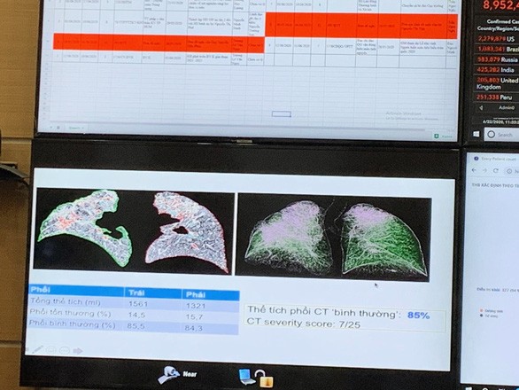 Đánh giá hồi phục của phi công người Anh giai đoạn trước và hiện tại (bên phải) - Ảnh: Lan Anh