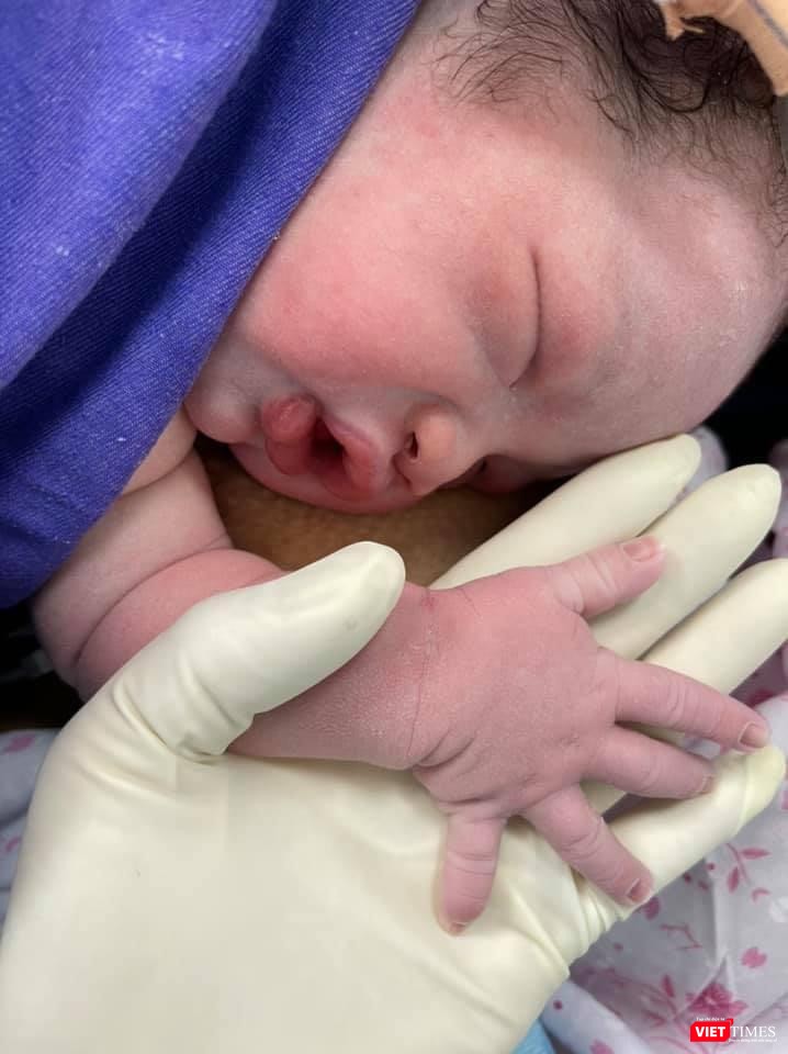 Những em bé được da kề da sau khi sinh (Ảnh: BVCC)