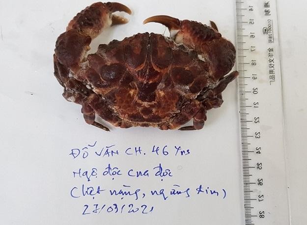 Mẫu cua tương tự loại cua bệnh nhân đã ăn được người nhà mang tới Trung tâm Chống độc BV Bạch Mai Mẫu cua tương tự loại cua bệnh nhân đã ăn được người nhà mang tới Trung tâm Chống độc BV Bạch Mai