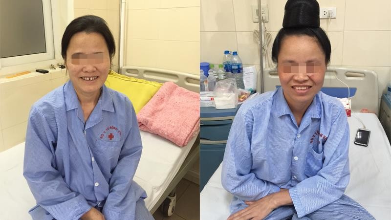 Hai bệnh nhân đã hồi phục sau ca mổ Hai bệnh nhân đã hồi phục sau ca mổ