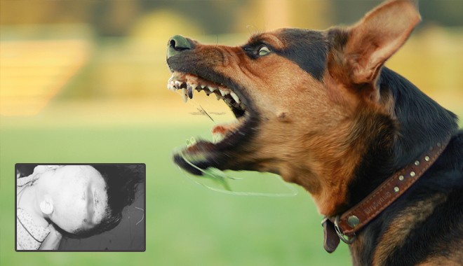 Chó nhà tấn công khiến trẻ phải đi cấp cứu (Ảnh minh họa) Chó nhà tấn công khiến trẻ phải đi cấp cứu (Ảnh minh họa)