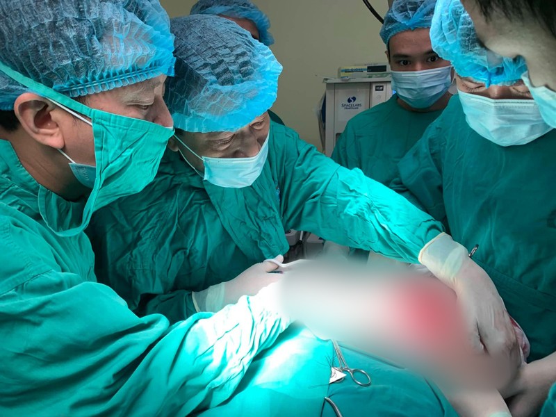 Mới 15 tháng tuổi, bé trai bị lồi mắt, nghẹt mũi vì khối u lớn chèn ép ảnh 3 Nữ bệnh nhân có khối u to như quả bưởi ở trên cổ 20 năm