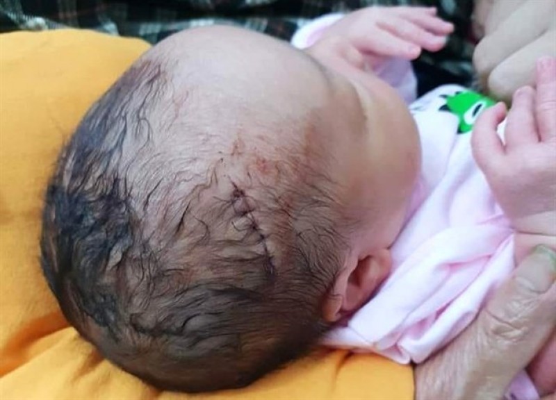 Bé trai phải chịu vết khâu 6 mũi ngay từ khi chào đời Bé trai phải chịu vết khâu 6 mũi ngay từ khi chào đời