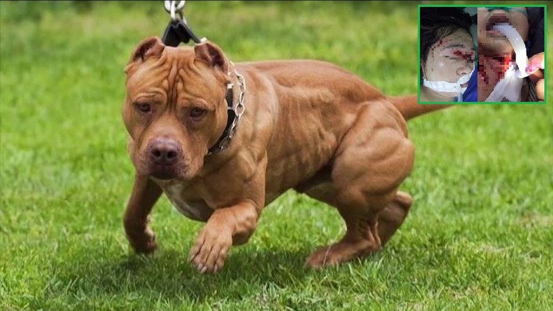 Cứu sống ca đột quỵ do tắc mạch máu não trong gang tấc ảnh 3 Thái Nguyên: Chó Pitbull tấn công khiến em bé 4 tuổi và người thân nhập viện