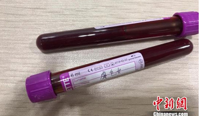 Mỗi ống máu xét nghiệm đều gắn tên một thai phụ (Ảnh: SCMP)