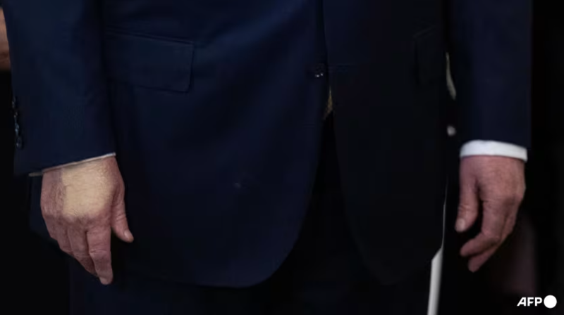 Ông Trump được chẩn đoán suy tĩnh mạch chân, Nhà Trắng nói gì 2.png