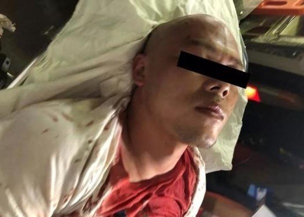 Một người Trung Quốc bị thương nặng do ẩu đả tại Campuchia. Một người Trung Quốc bị thương nặng do ẩu đả tại Campuchia.