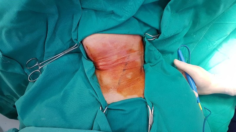 Hình ảnh tổn thương của bệnh nhân. Ảnh: Bệnh viện cung cấp
