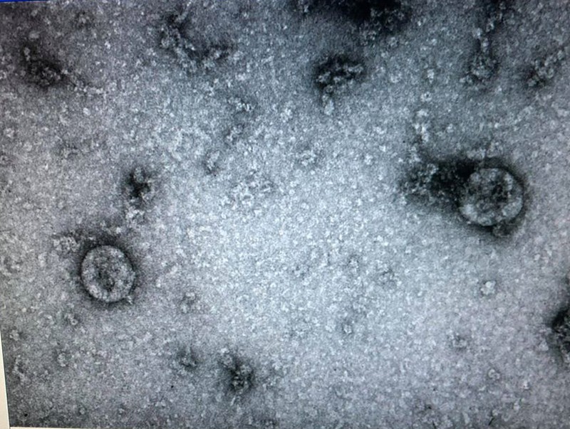 Nóng: Nuôi cấy, phân lập thành công virus Corona mới , Việt Nam có thể xét nghiệm hàng nghìn mẫu/ngày