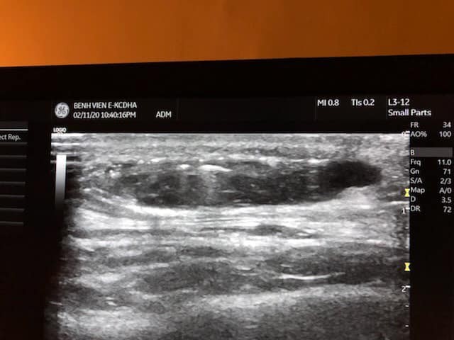 Phim chụp của bệnh nhân. Ảnh: Bệnh viện E