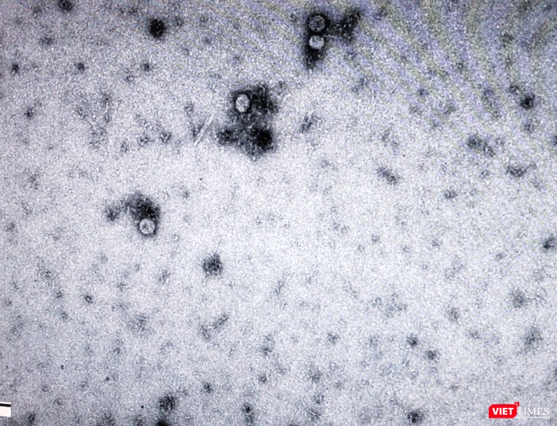 Virus SARS-CoV-2 được phân lập thành công tại Viện Vệ sinh dịch tễ Trung ương. Ảnh: Minh Thúy