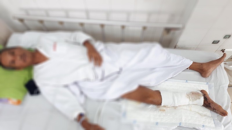 Người đàn ông suýt mất mạng vì ăn gỏi cá rô phi có tả biển 