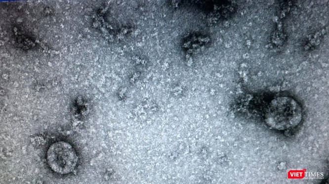 virus SARS-CoV-2 (Ảnh - Minh Thuý) virus SARS-CoV-2 (Ảnh - Minh Thuý)