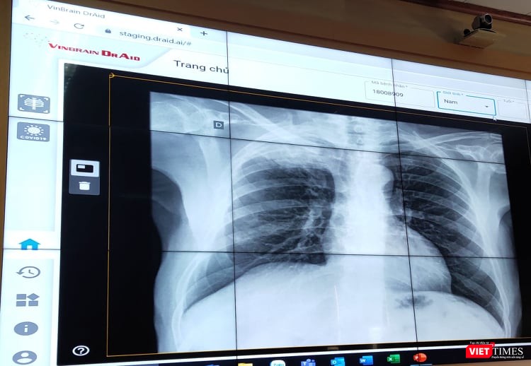 Ứng dụng VinBrain DrAi. (Ảnh: Minh Thúy)