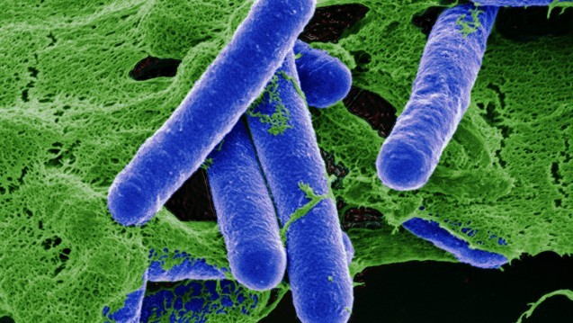 Vi khuẩn Clostridium botulinum (Ảnh: Dr.Gary Gaugler/OKAPIA)