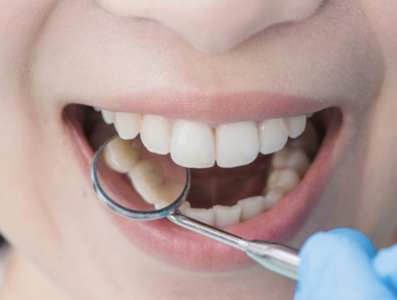 Xoài xanh ngừa sâu răng (Ảnh: Bold Sky) Xoài xanh ngừa sâu răng (Ảnh: Bold Sky)