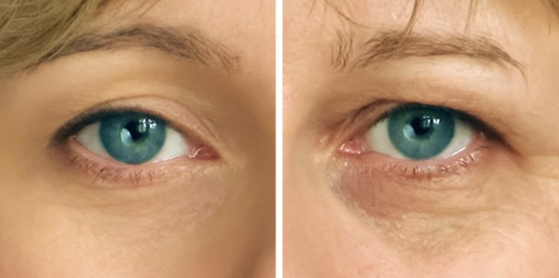 Tập thể dục da mặt có thể gây ra nếp nhăn (Ảnh: BrightSide) Tập thể dục da mặt có thể gây ra nếp nhăn (Ảnh: BrightSide)