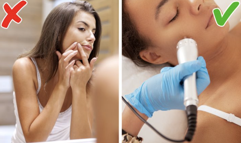 Không nên tự nặn mụn (Ảnh: BrightSide) Không nên tự nặn mụn (Ảnh: BrightSide)