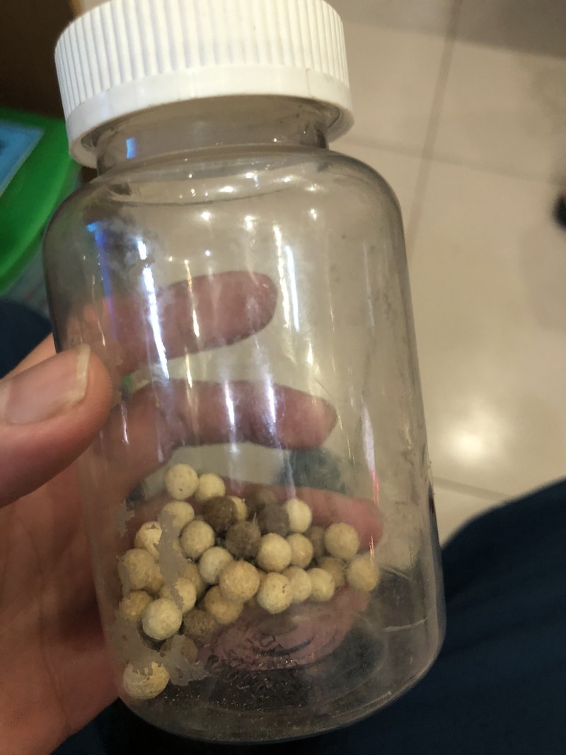 Viên thuốc nam trị tiểu đường khiến ông P. phải lọc máu thải độc (Ảnh: BVCC) Viên thuốc nam trị tiểu đường khiến ông P. phải lọc máu thải độc (Ảnh: BVCC)