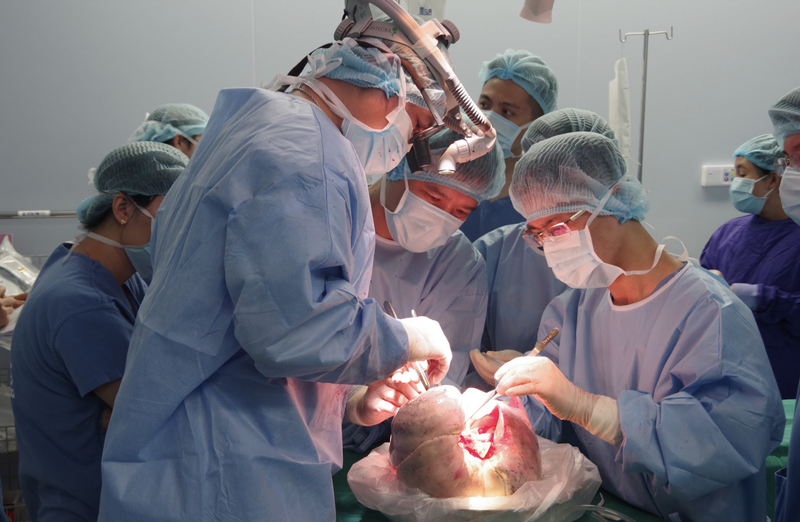 Các bác sĩ ghép phổi cho bệnh nhân bị xơ phổi nguyên phát (Ảnh: BVCC)