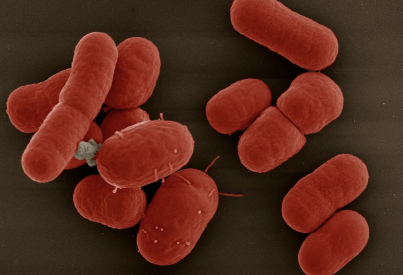 Một siêu vi khuẩn đa kháng thuốc (Ảnh minh hoạ)