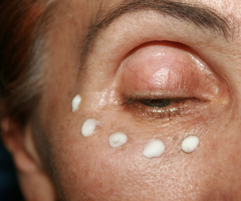 Kem dưỡng ẩm là vũ khí lợi hại đánh bay quầng thâm (Ảnh: Brightside) Kem dưỡng ẩm là vũ khí lợi hại đánh bay quầng thâm (Ảnh: Brightside)