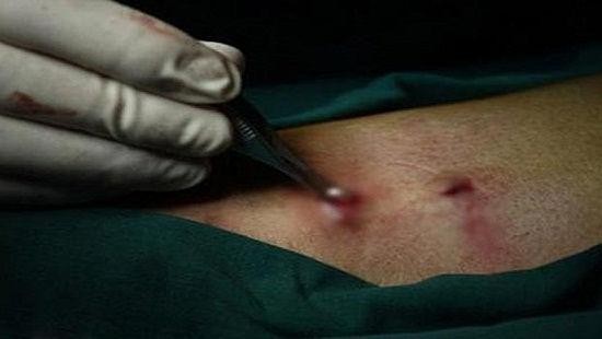 Phẫu thuật ở phòng khám tư tiềm ẩn nhiều rủi ro không thể lường trước (Ảnh minh hoạ) Phẫu thuật ở phòng khám tư tiềm ẩn nhiều rủi ro không thể lường trước (Ảnh minh hoạ)