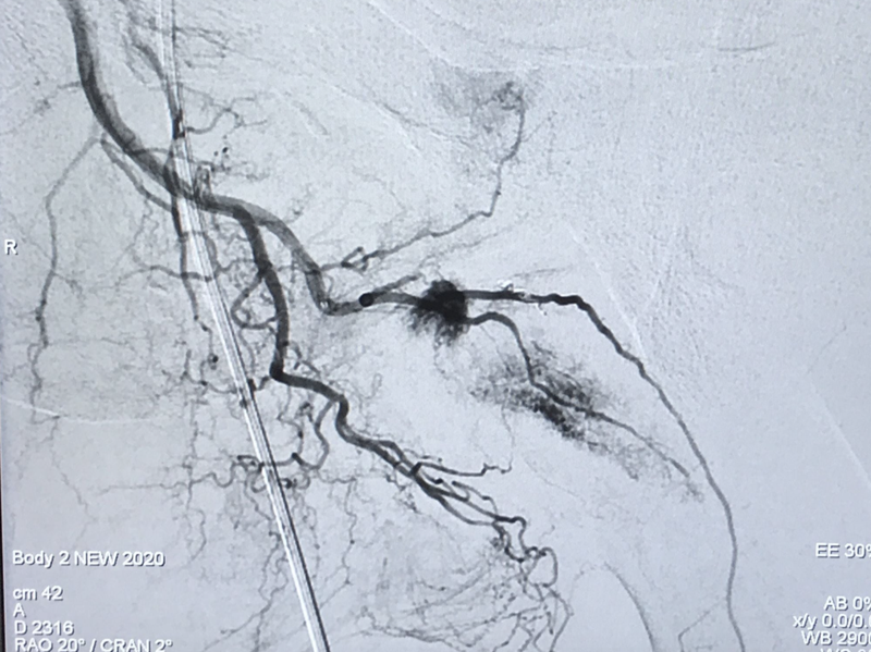 Ảnh chụp tình trạng của bệnh nhân (Ảnh - BVCC) Ảnh chụp tình trạng của bệnh nhân (Ảnh - BVCC)