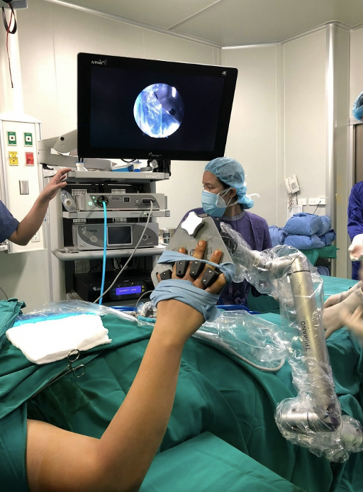 Các bác sĩ khoa Phẫu thuật Chi trên và Y học thể thao, Bệnh viện Hữu nghị Việt Đức đang phẫu thuật cho bệnh nhân T (Ảnh - BVCC) Các bác sĩ khoa Phẫu thuật Chi trên và Y học thể thao, Bệnh viện Hữu nghị Việt Đức đang phẫu thuật cho bệnh nhân T (Ảnh - BVCC)