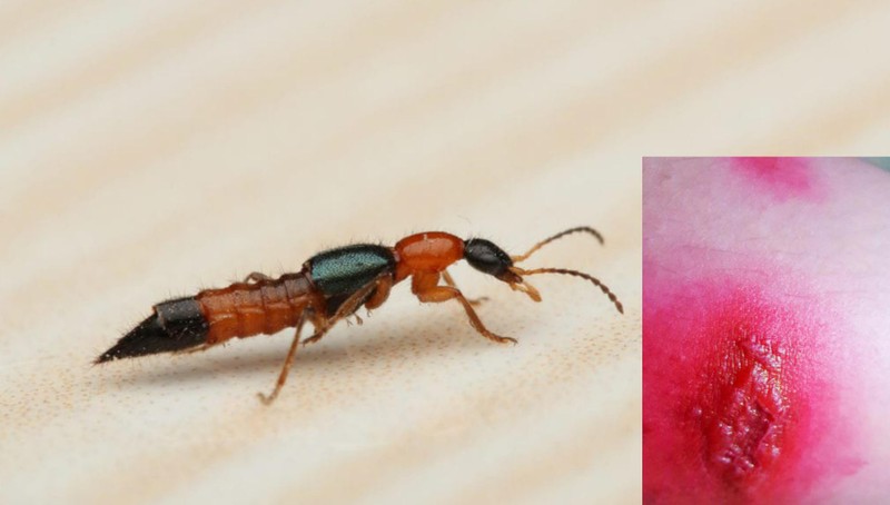 Sinh viên than trời vì kiến ba khoang “tấn công” dữ dội