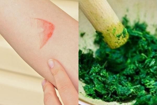 Dân gian thường dùng rau má để trị vết bỏng Dân gian thường dùng rau má để trị vết bỏng