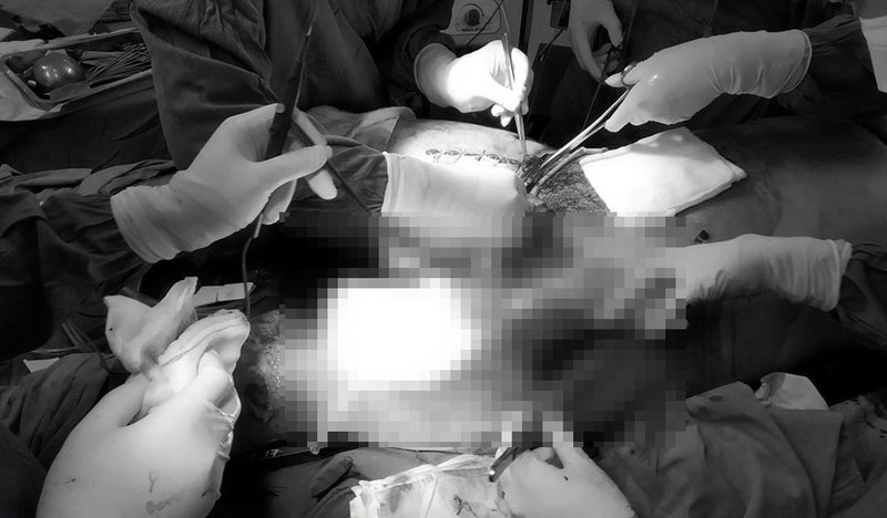 Bác sĩ quyết định áp dụng áp dụng qui trình báo động đỏ cấp cứu trường hợp khẩn cấp. Ảnh: BVCC