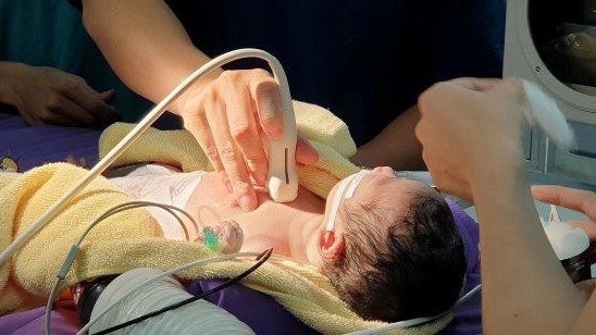Cứu sống em bé có nguy cơ tử vong ngay từ khi lọt lòng