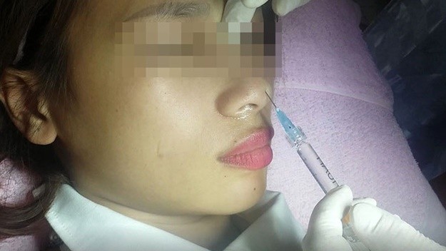 Cứu sống ca đột quỵ do tắc mạch máu não trong gang tấc ảnh 6 Phát hiện súng tại cơ sở làm đẹp “chui” tại chung cư Vinhomes Central Park